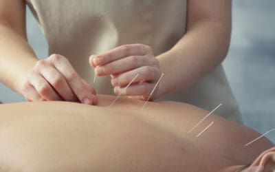 The Science of Acupuncture: How It Works