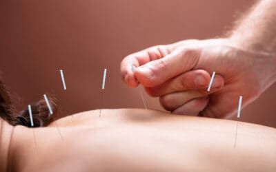 Boost Your Energy with Regular Acupuncture