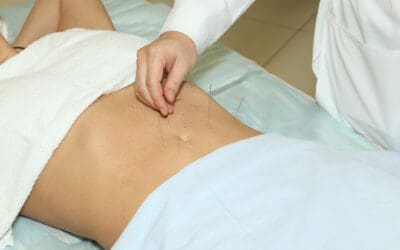 Achieving Weight Loss Goals Through Acupuncture and Herbal Remedies