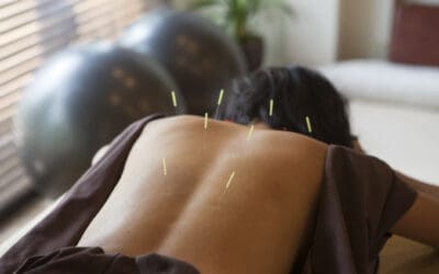 What to Expect at Your First Acupuncture Appointment in Albuquerque