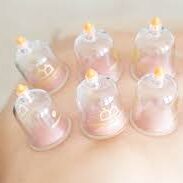 best cupping Albuquerque